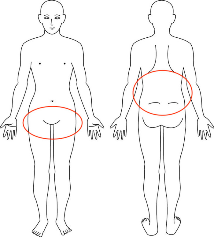 【症例】抱っこひもをして痛む恥骨痛は姿勢と付け方が原因